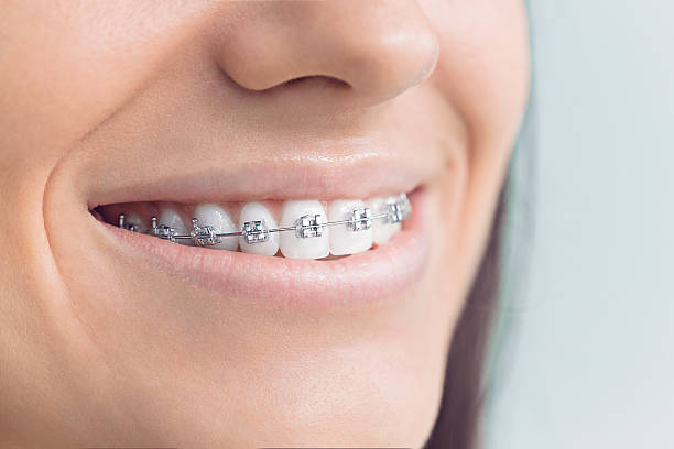 Advanced Technology for Better Dental Care in Whitemarsh Island, GA